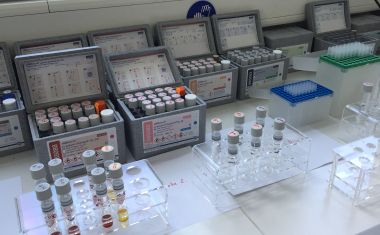 Mehrere Kästen mit Reagenzgläsern und Pipetten